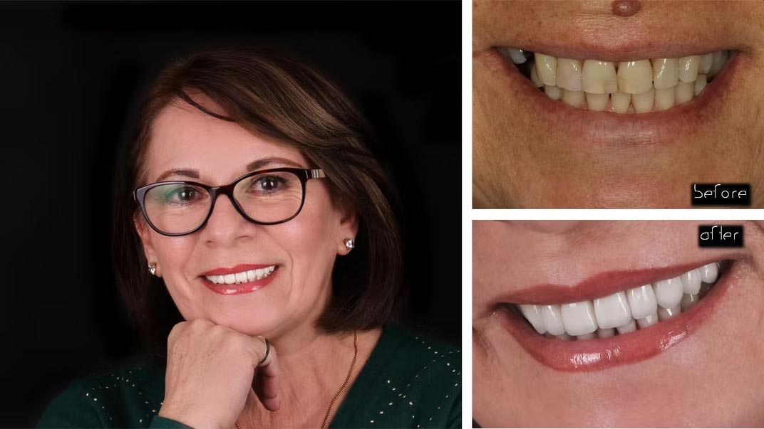 The image shows a woman with a bright smile, displaying her teeth, and wearing glasses, set against a dark background.