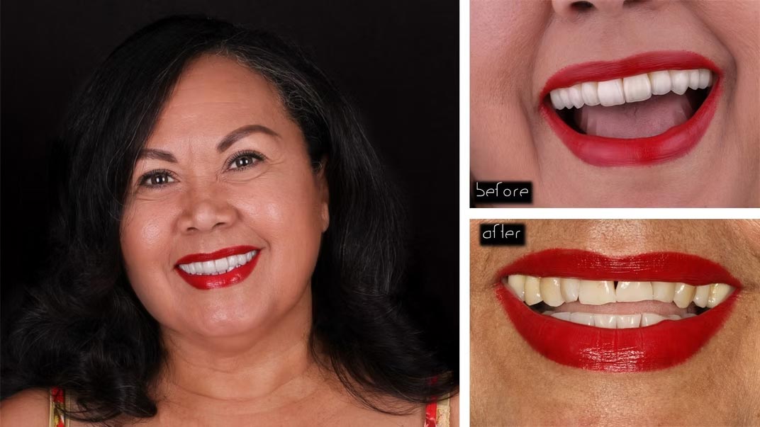The image shows a woman with red lipstick smiling broadly, with four separate photos of her face displayed side by side, each capturing different expressions or angles.