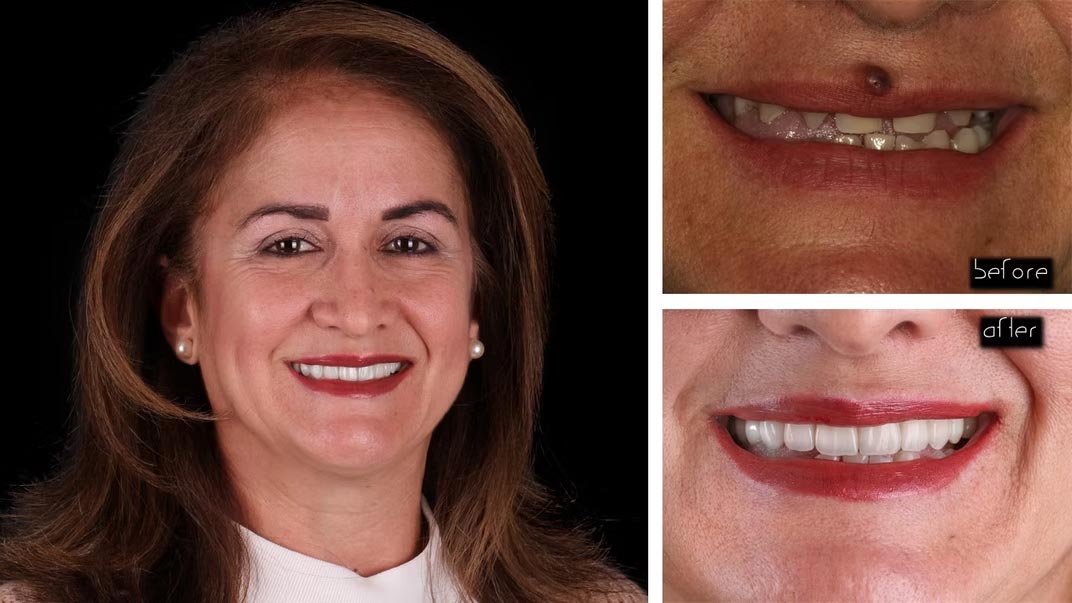 The image shows a woman with dark hair smiling at the camera, wearing makeup including red lipstick, and has a large gap between her front teeth.