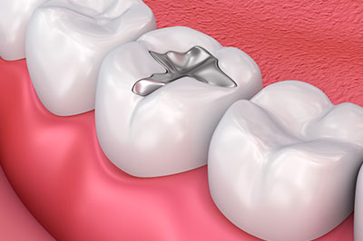 An image depicting a set of teeth with a silver ring embedded between two front teeth, set against a red background.