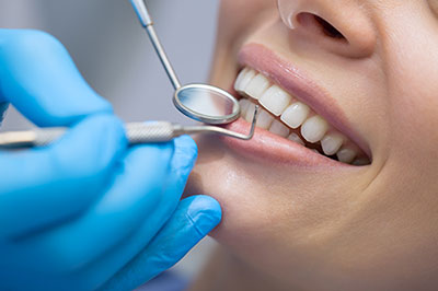 A woman receiving dental care with her mouth open while seated in a dental chair.