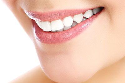 The image shows a close-up of a person s smiling face with their teeth visible, set against a neutral background.