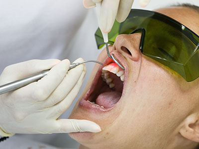The image depicts a person undergoing oral surgery with a dentist performing the procedure, using specialized dental instruments visible around their mouth.
